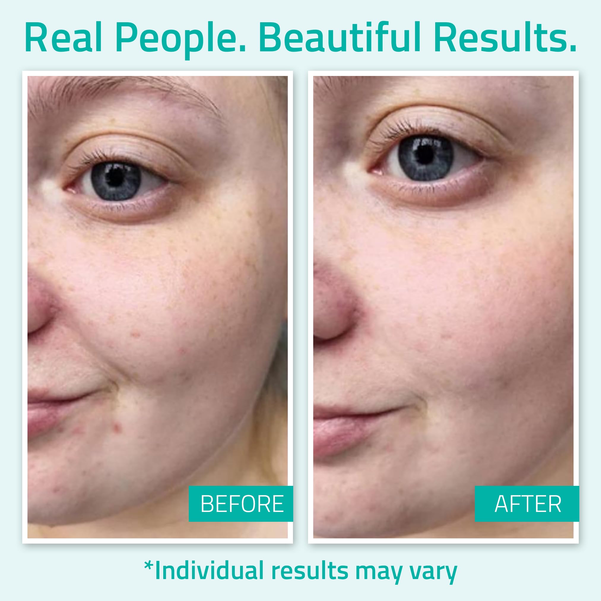 YEOUTH Hyaluronic Acid Serum label close-up highlights clean formula.