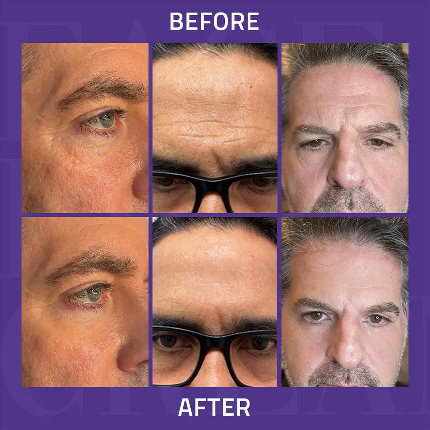 YEOUTH Instant Face Lift Cream used in daily skincare routine for refreshed appearance.