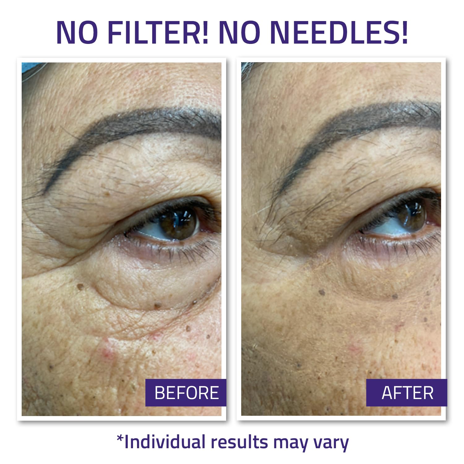 YEOUTH Instant Face Lift Cream targets under eye wrinkles for smoother appearance.