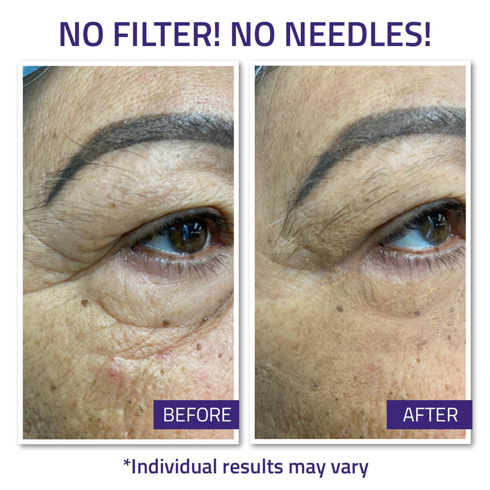YEOUTH Instant Face Lift Cream targets under eye wrinkles for smoother appearance.