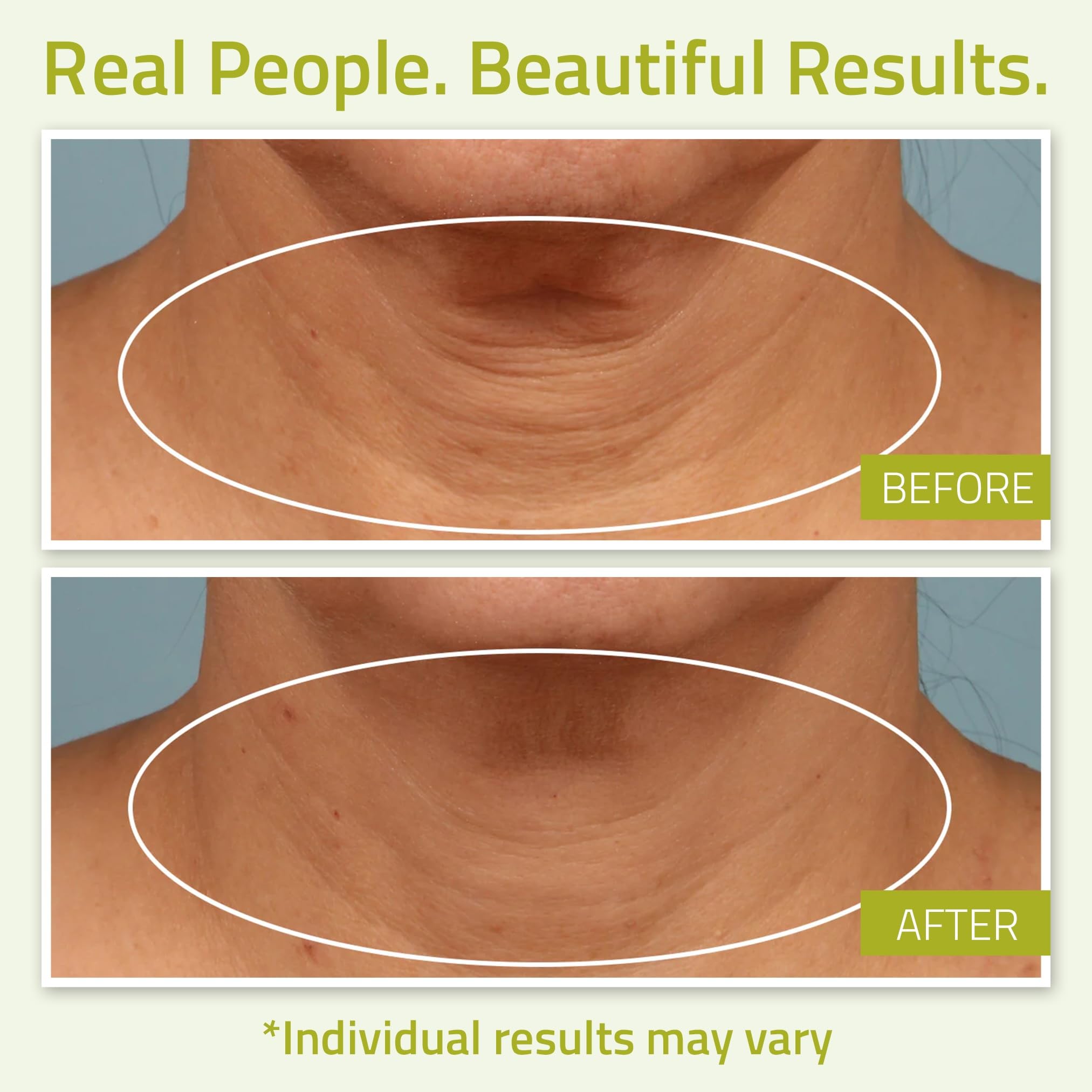 YEOUTH Neck Cream tube dispense demonstrates convenient application