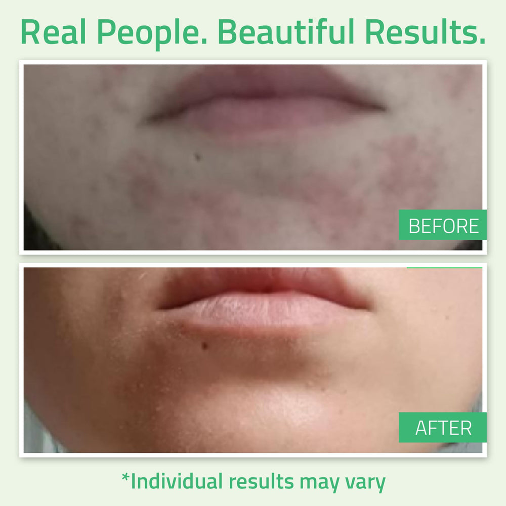 YEOUTH retinol and green tea formulation close-up suggesting brightening potential.