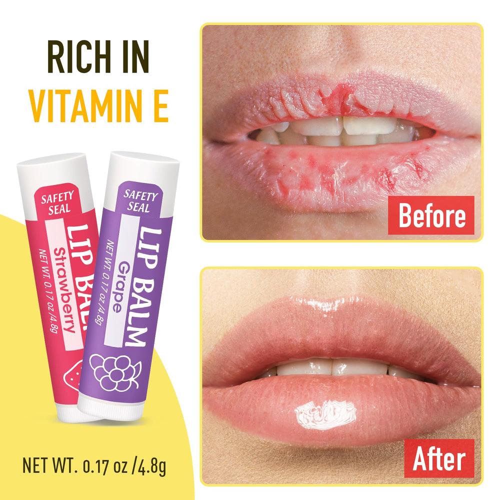 YesBes watermelon flavor lip balm keeps lips moisturized with a light fruity aroma