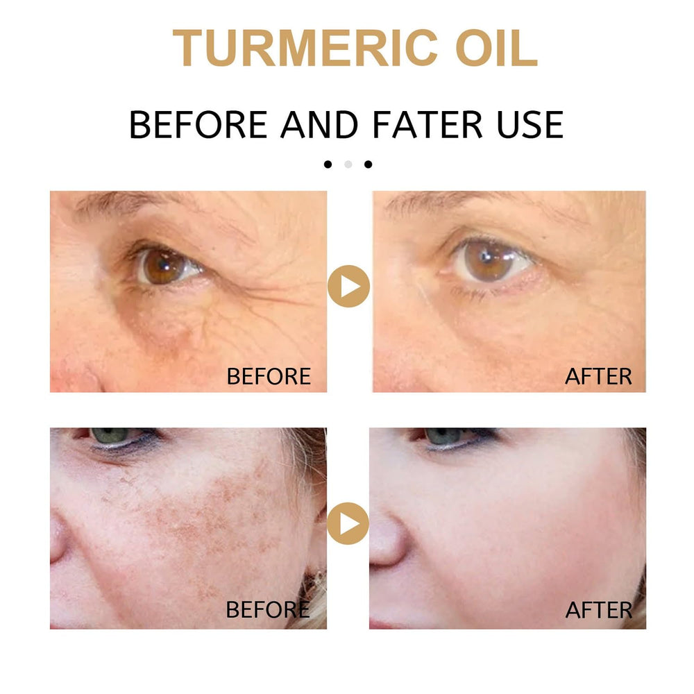 YG LianKai turmeric serum promotes brighter skin with regular use.