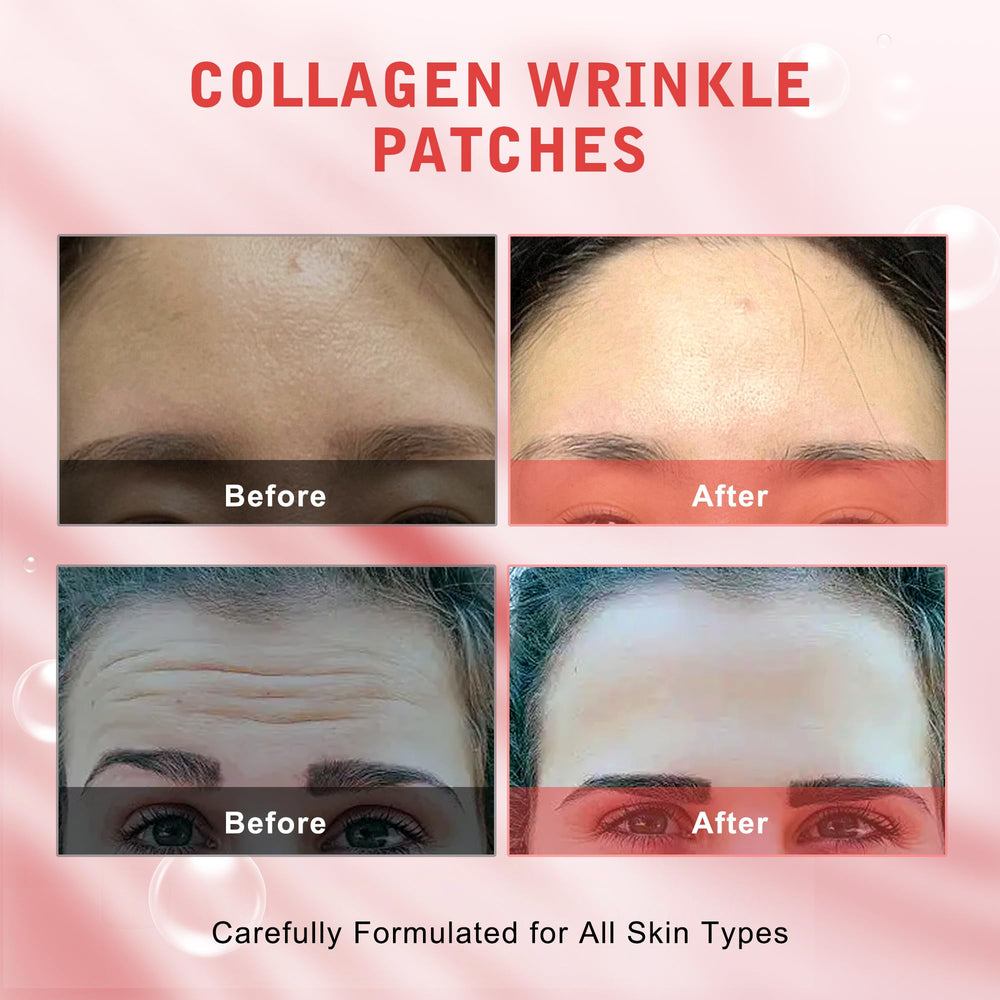YIMEIR forehead wrinkle patches 16-pack — versatile day or night usage