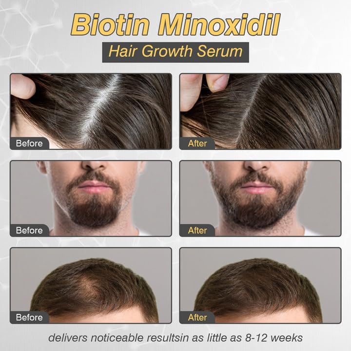 YKDILYHH scalp care scene emphasizes follicle support and hair strength over time.