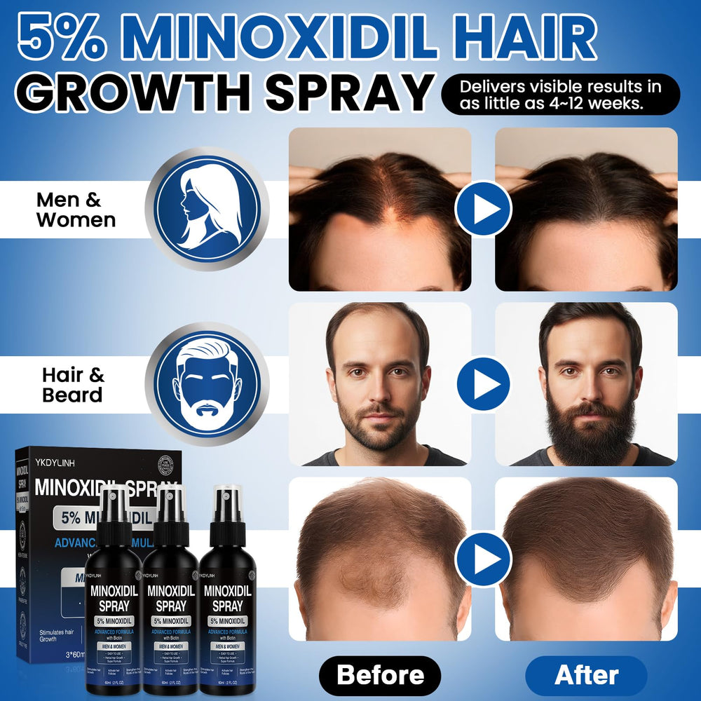 YKDYLINH Minoxidil spray nozzle close-up highlighting easy spray design