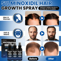 YKDYLINH Minoxidil spray nozzle close-up highlighting easy spray design
