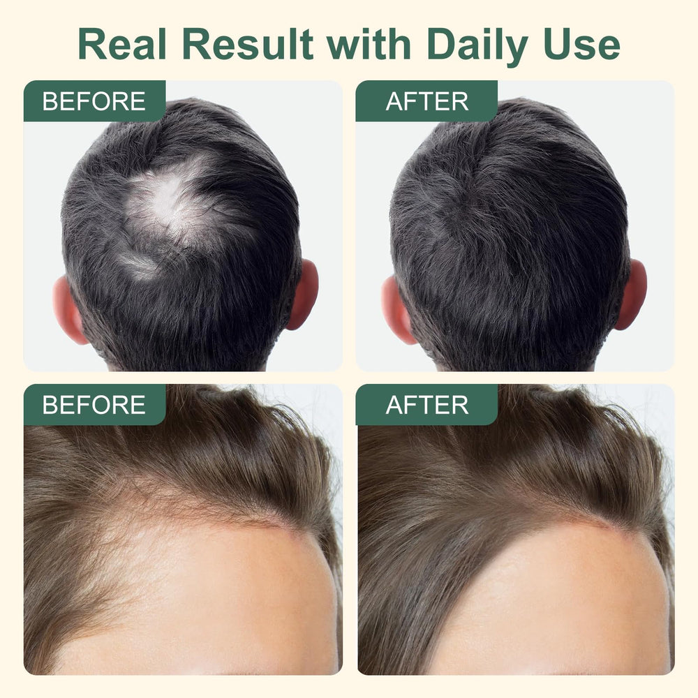 YNGLLC minoxidil hair growth application scene for easy routine integration