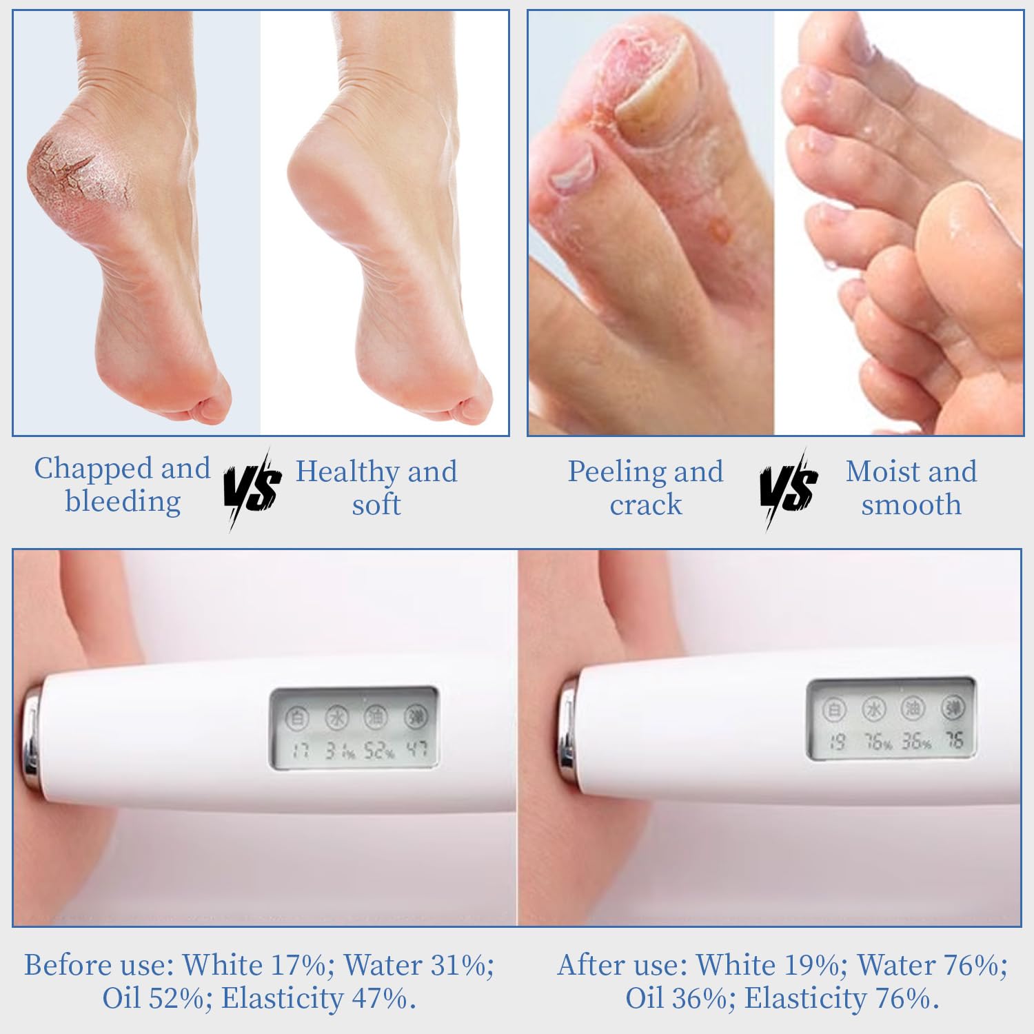 YOUNGYOUNGLOVE Urea Cream non-greasy-finish signals fast absorption and comfortable wear.