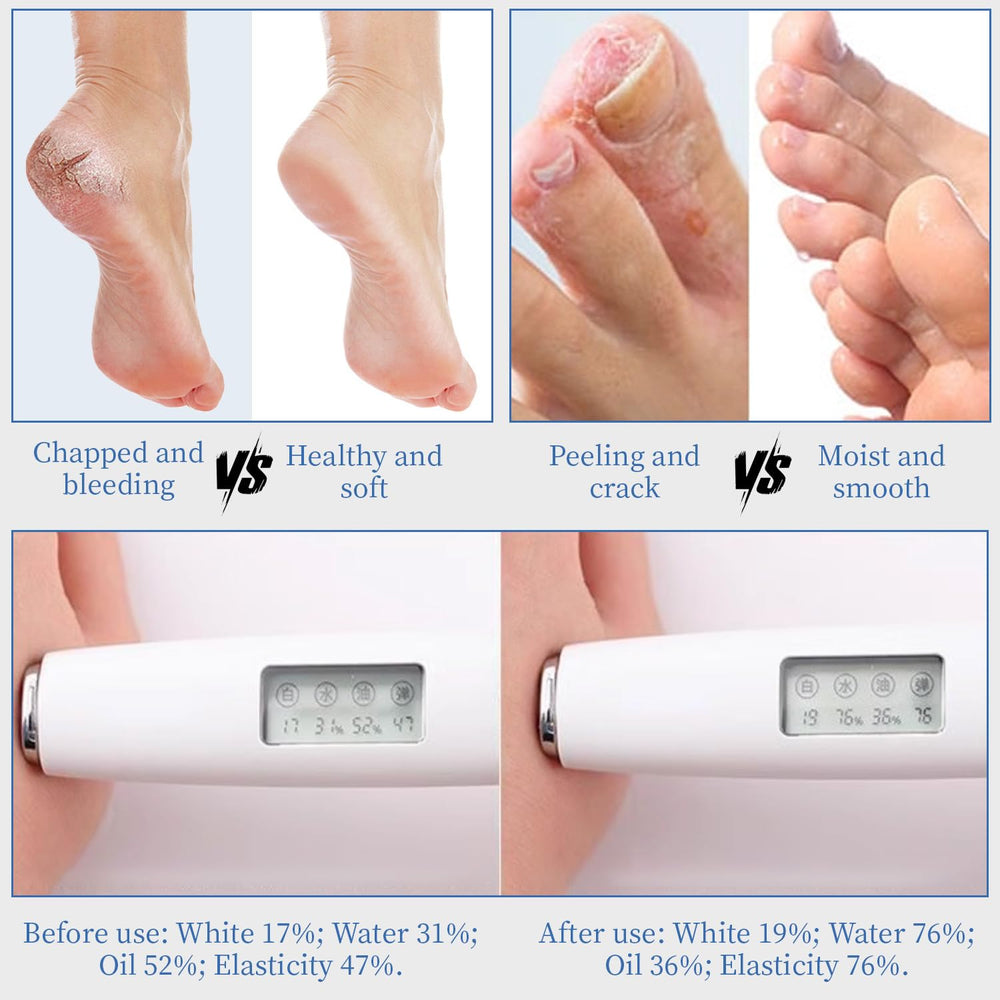 YOUNGYOUNGLOVE Urea Cream non-greasy-finish signals fast absorption and comfortable wear.