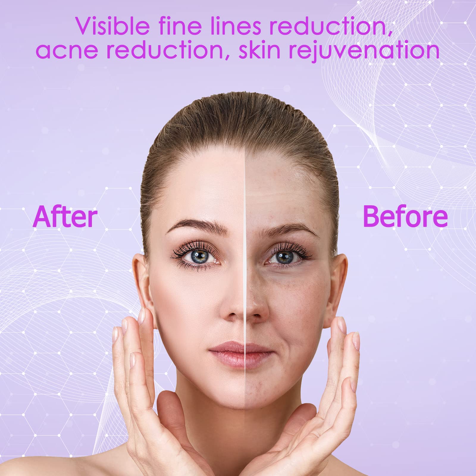 YourMate tongue tube attachment for the T-zone skincare