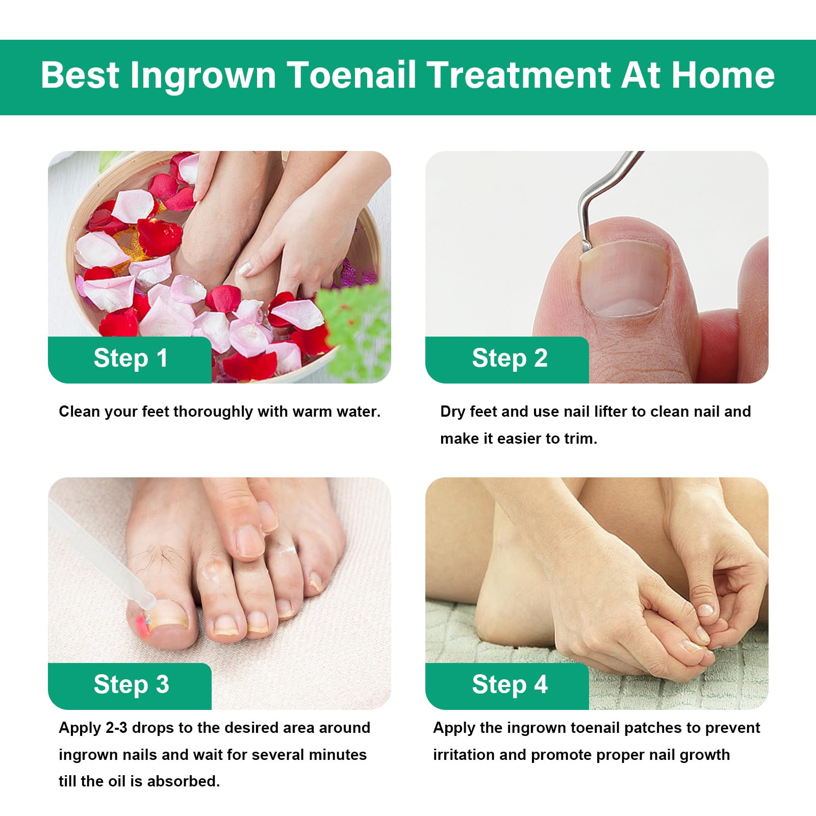 YOUVLAN nail separator facilitates gentle lifting for easier trimming.