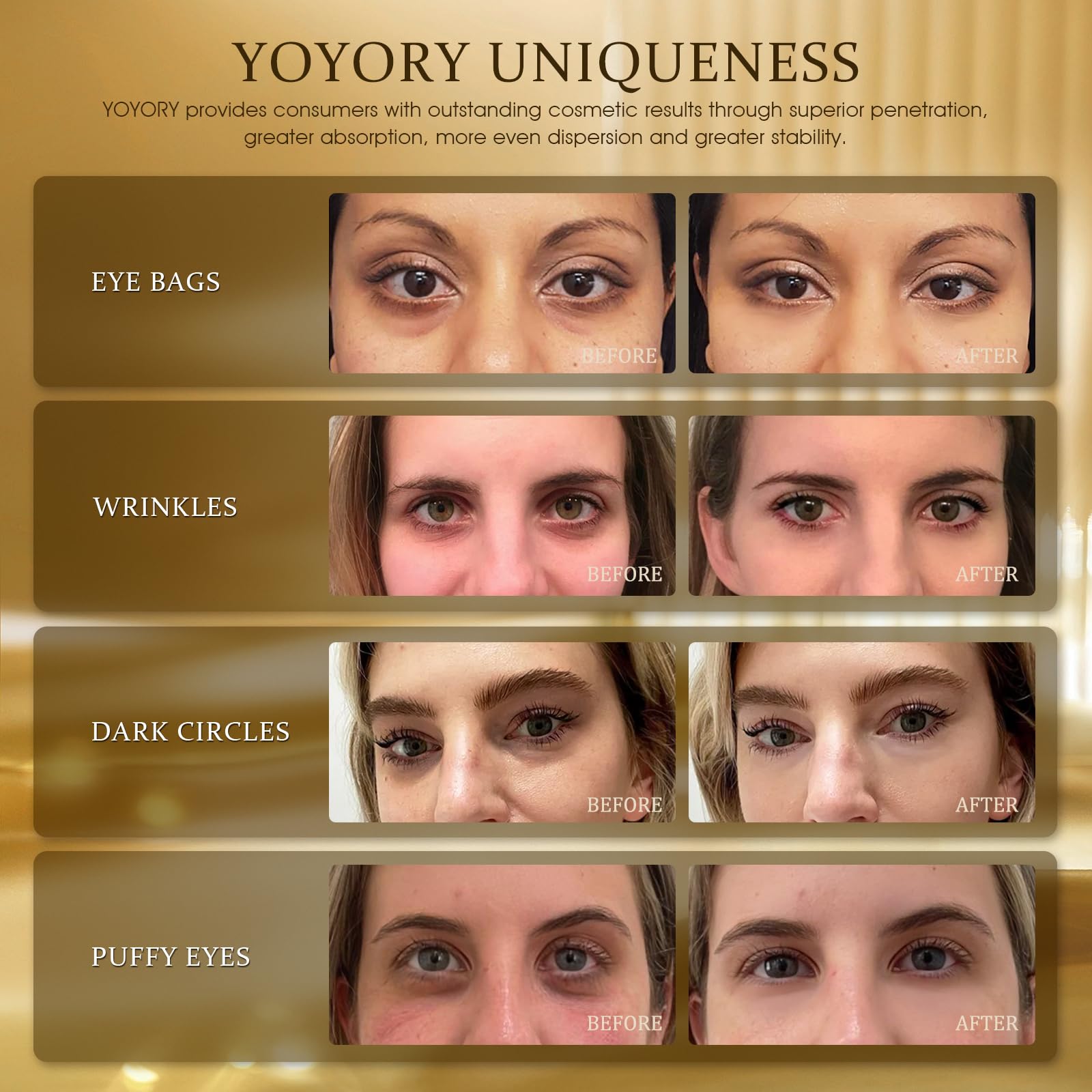 YOYORY hydrogel eye patches reduce under-eye puffiness with cooling hydration.