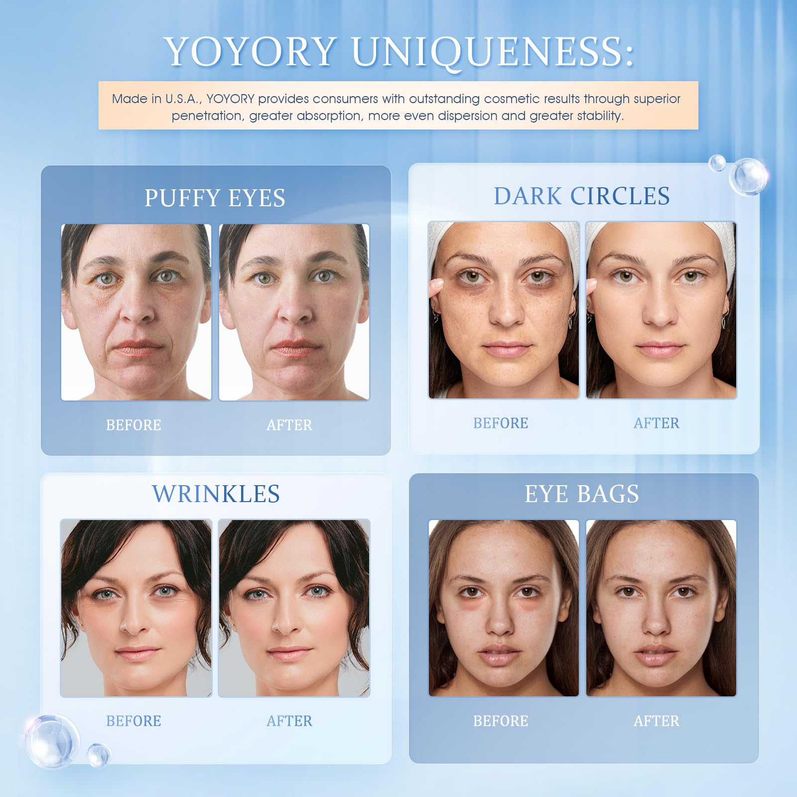 YOYORY under-eye patches 30-pairs pack, travel-friendly care kit for busy schedules.