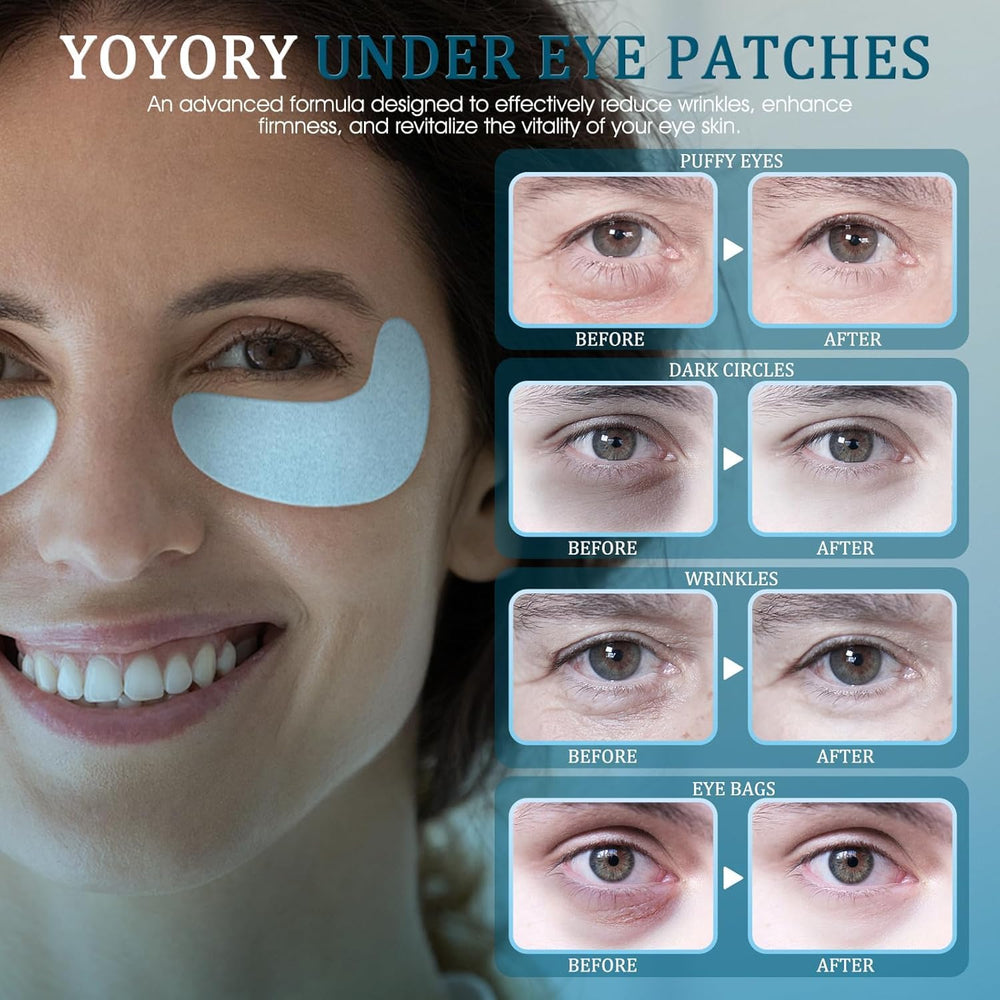 YOYORY under-eye patches box open showing 30 pairs
