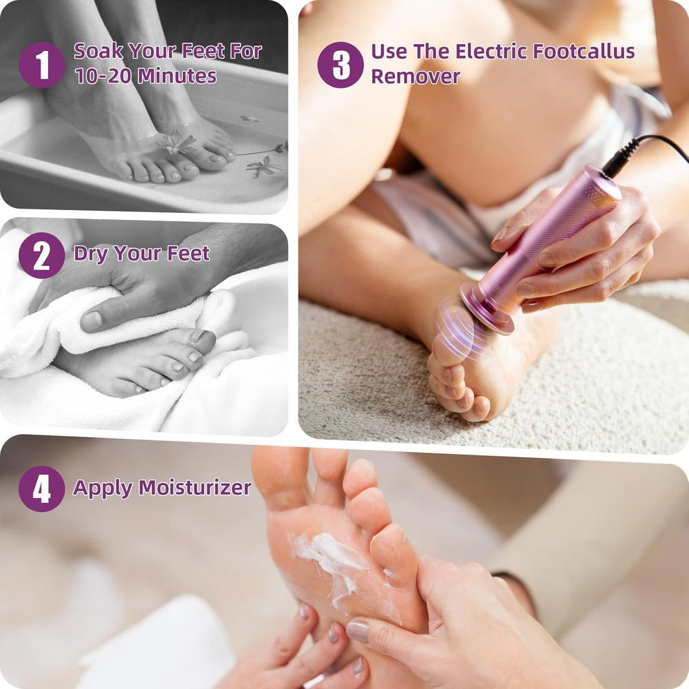 YPWRENH electric foot callus remover with diamond grinder for smoother heels