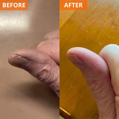 Yu-Be Moisturizing Skin Cream application close-up demonstrates fast-absorbing, non-greasy formula.