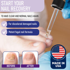 ZanaQuick 2-pack box highlights value and ongoing nail care.