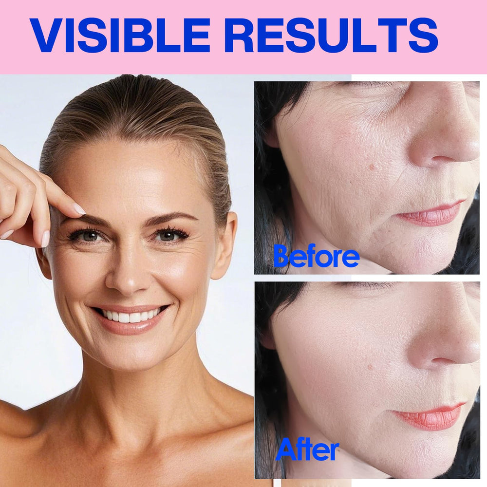 Zancony face tape crow-feet-patch reduces visible eye-area lines for a softer look