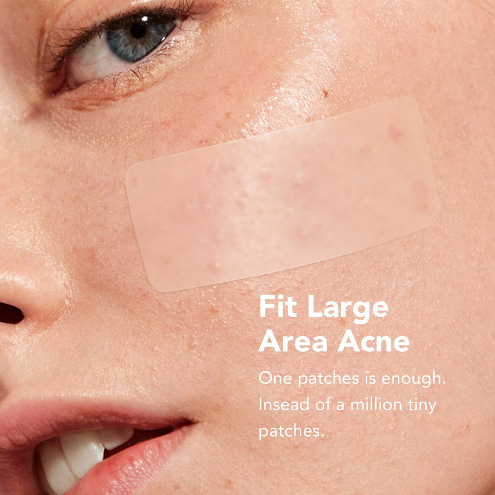 ZATKTK Pimple Patches applied on back demonstrates broad coverage benefits.
