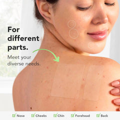 ZATKTK Pimple Patches XL 60x60mm for large-area coverage.
