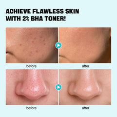 ZealSea Salicylic Acid Toner Niacinamide and CICA blend for calm, balanced skin.
