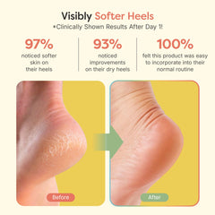 ZenToes Moisturizing Socks jojoba oil infusion supports skin hydration.