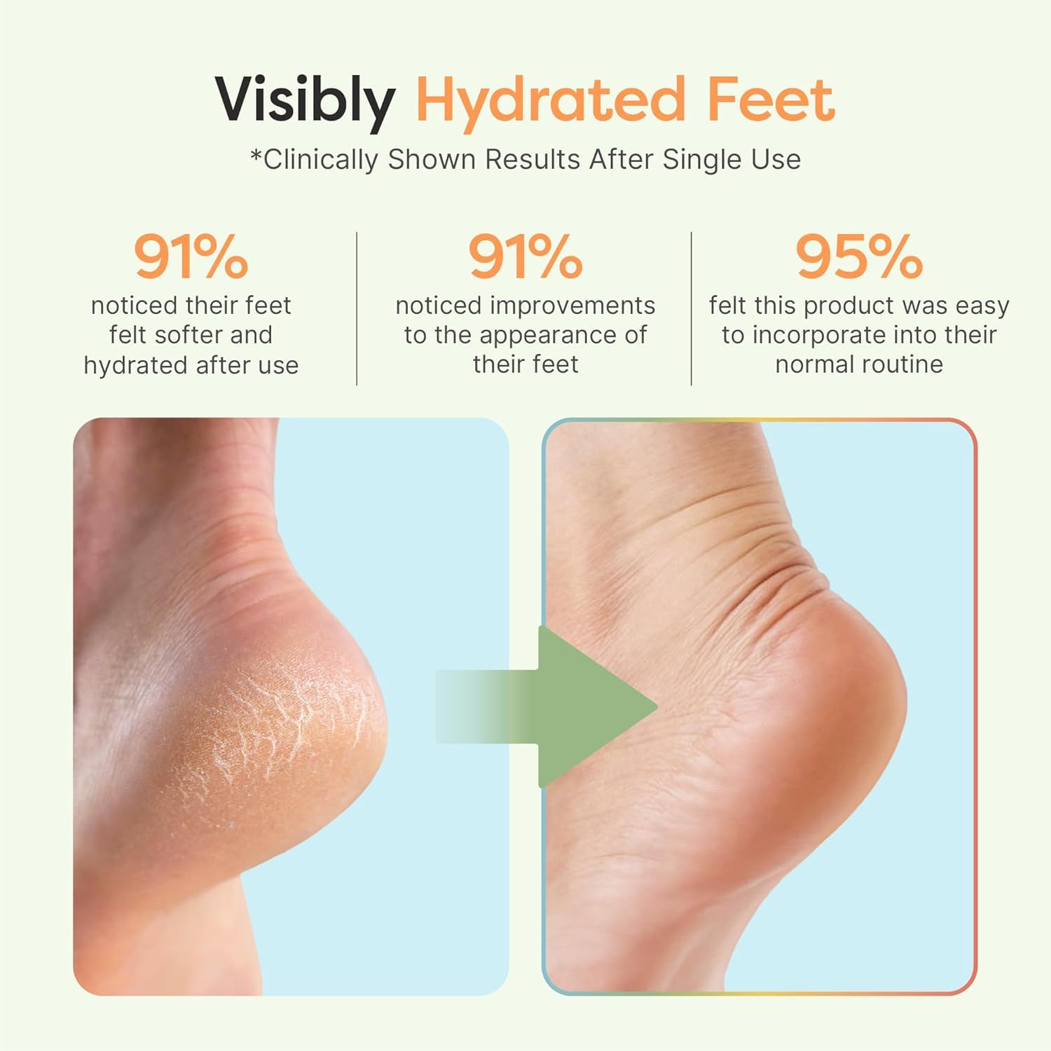ZenToes Moisturizing Socks with jojoba oil olive oil and vitamin E for hydration