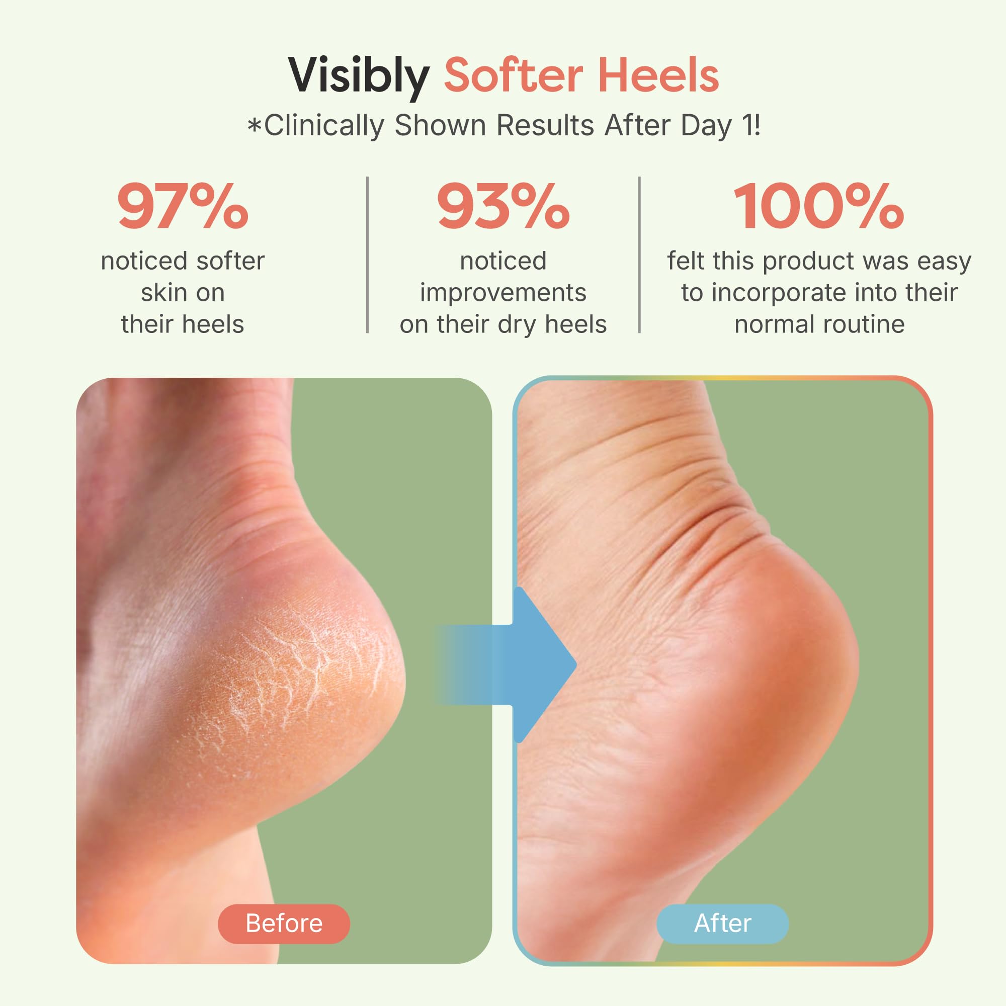 ZenToes vitamin E infused socks for deep moisturization during at-home pedicures