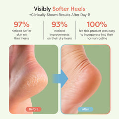 ZenToes vitamin E infused socks for deep moisturization during at-home pedicures