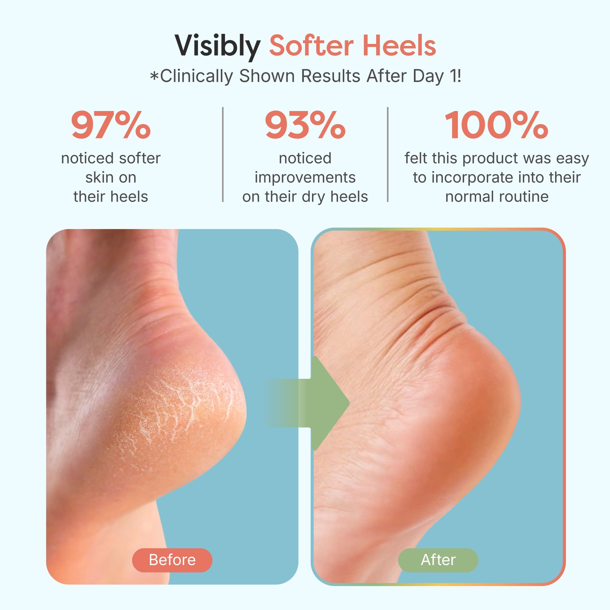 ZenToes vitamin E olive oil and jojoba oil infusion targets dry heels