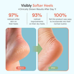 ZenToes vitamin E olive oil and jojoba oil infusion targets dry heels