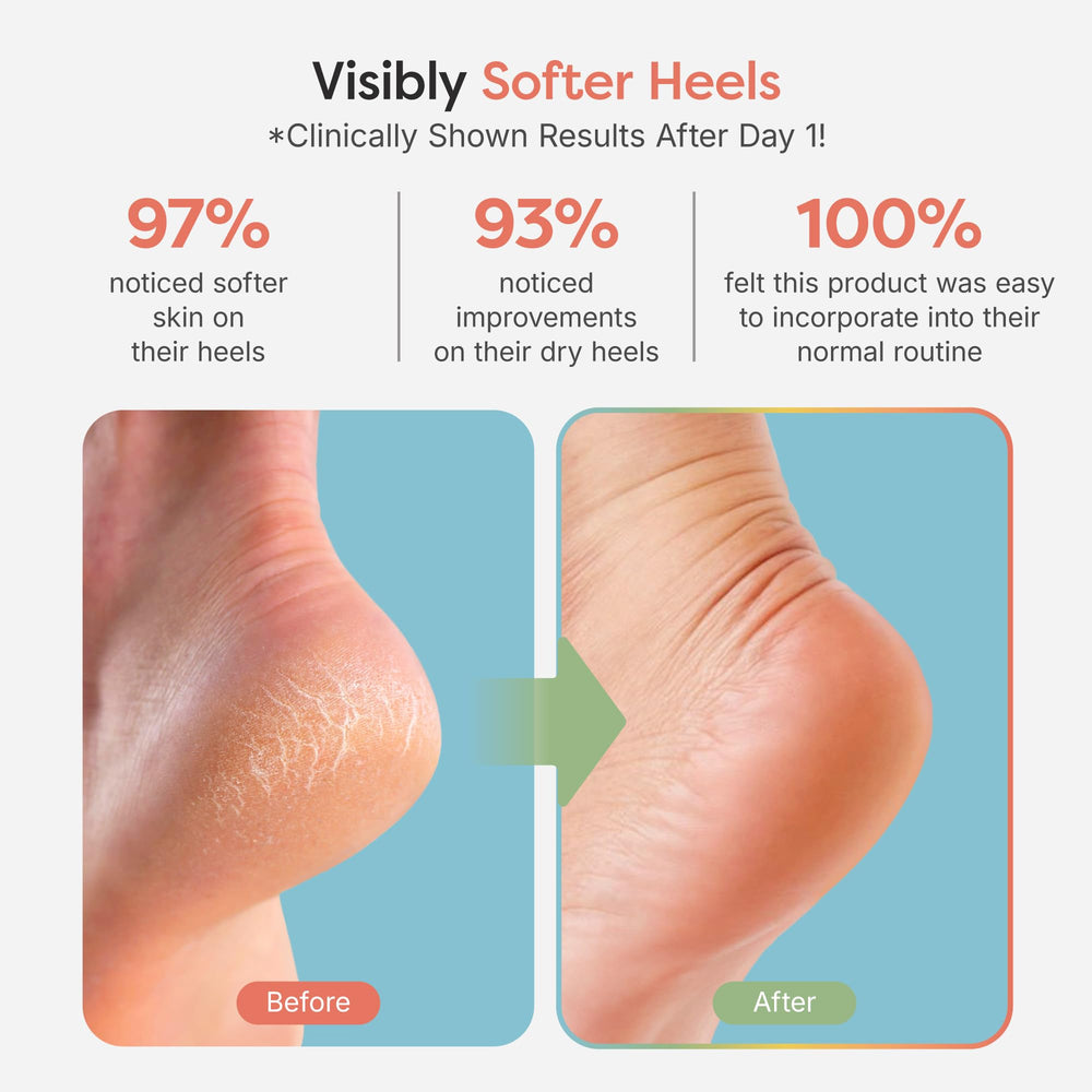 Vitamin E, olive oil and jojoba oil nourish ZenToes sock-lined gel area.