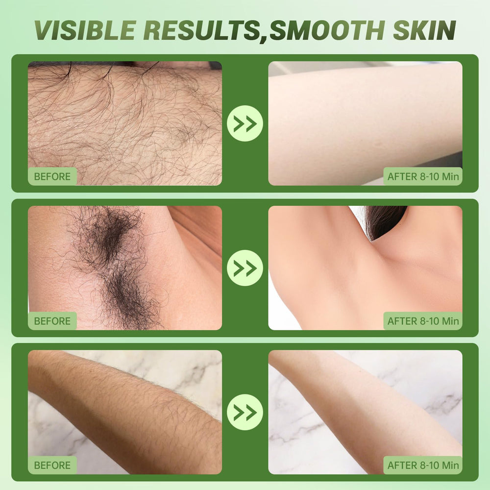 Zeponyx hair removal cream leg removal action for fast hair dissolution.