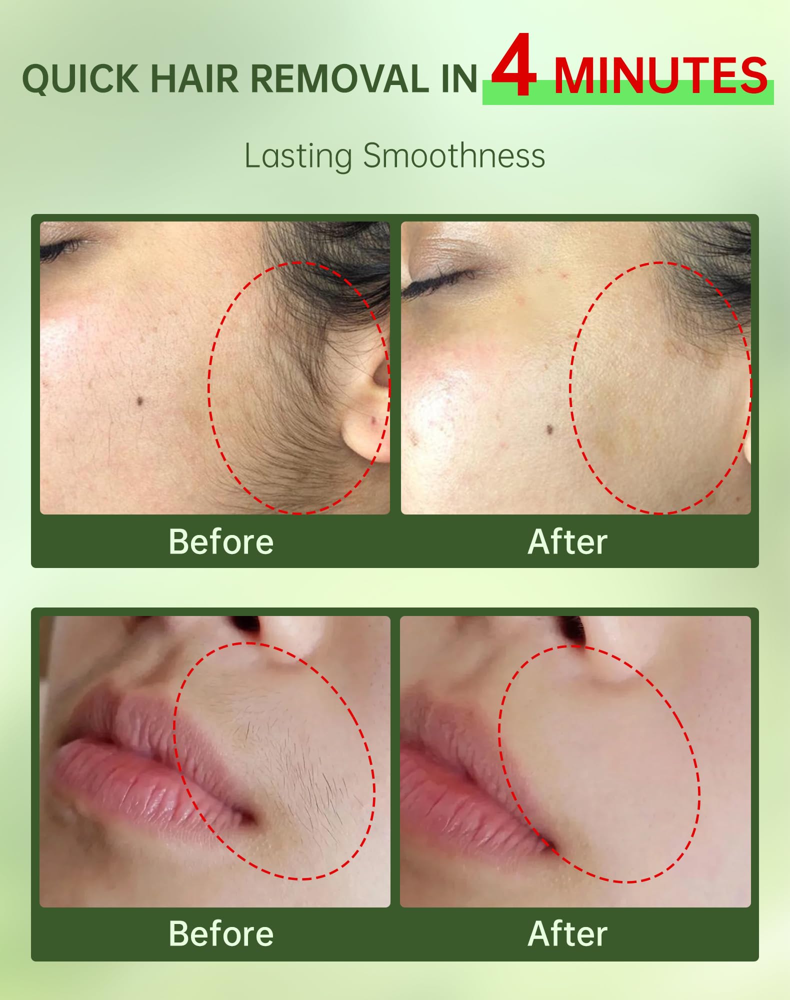 Zeponyx soothing cream with ceramide NP calms skin after removal