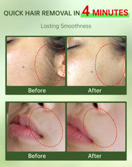 Zeponyx soothing cream with ceramide NP calms skin after removal