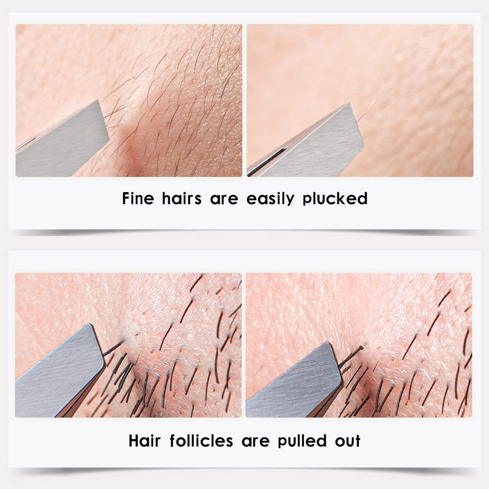 ZERNBER tweezers set stainless steel finish highlights durability and cleanability.