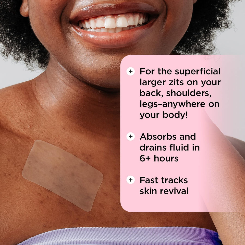 ZitSticka Goo Getter finger-proof barrier keeps hands away from the zit.