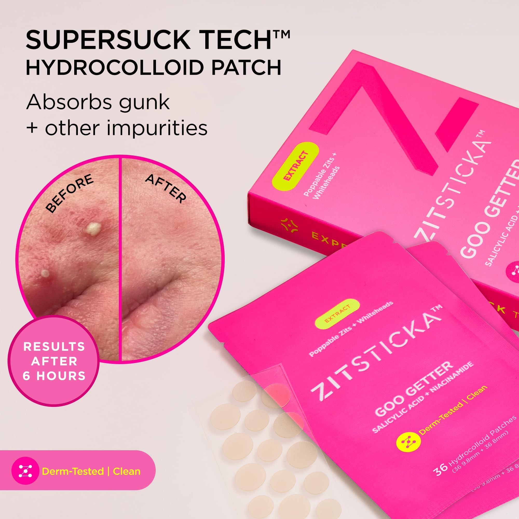 ZitSticka GOO GETTER hydrocolloid technology patch sealing moisture