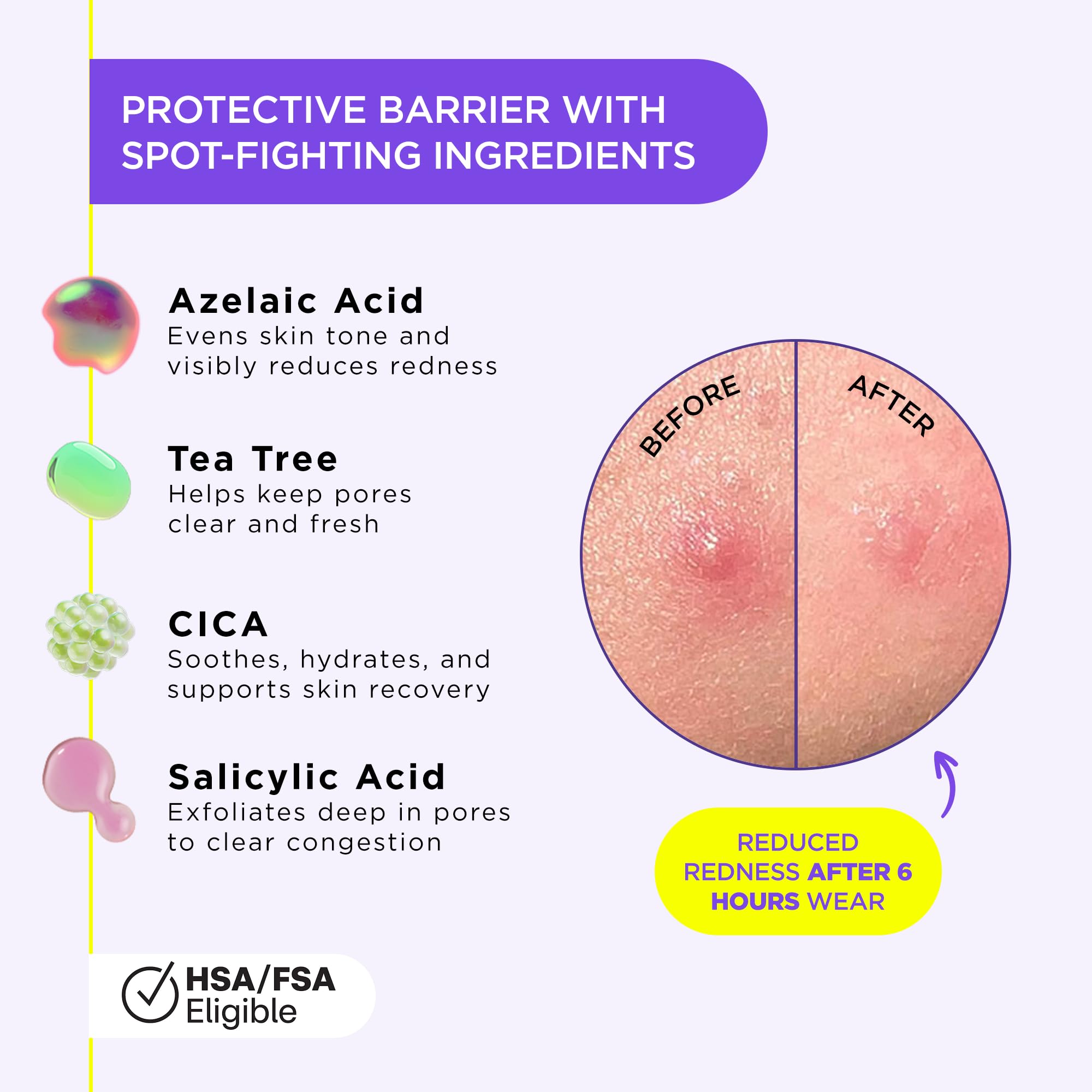 ZitSticka Liquid Pimple Patch tea tree cica salicylic acid ingredients—soothing active care