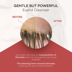 Zocular ZocuFoam promotes dry-eye relief after long screen time.