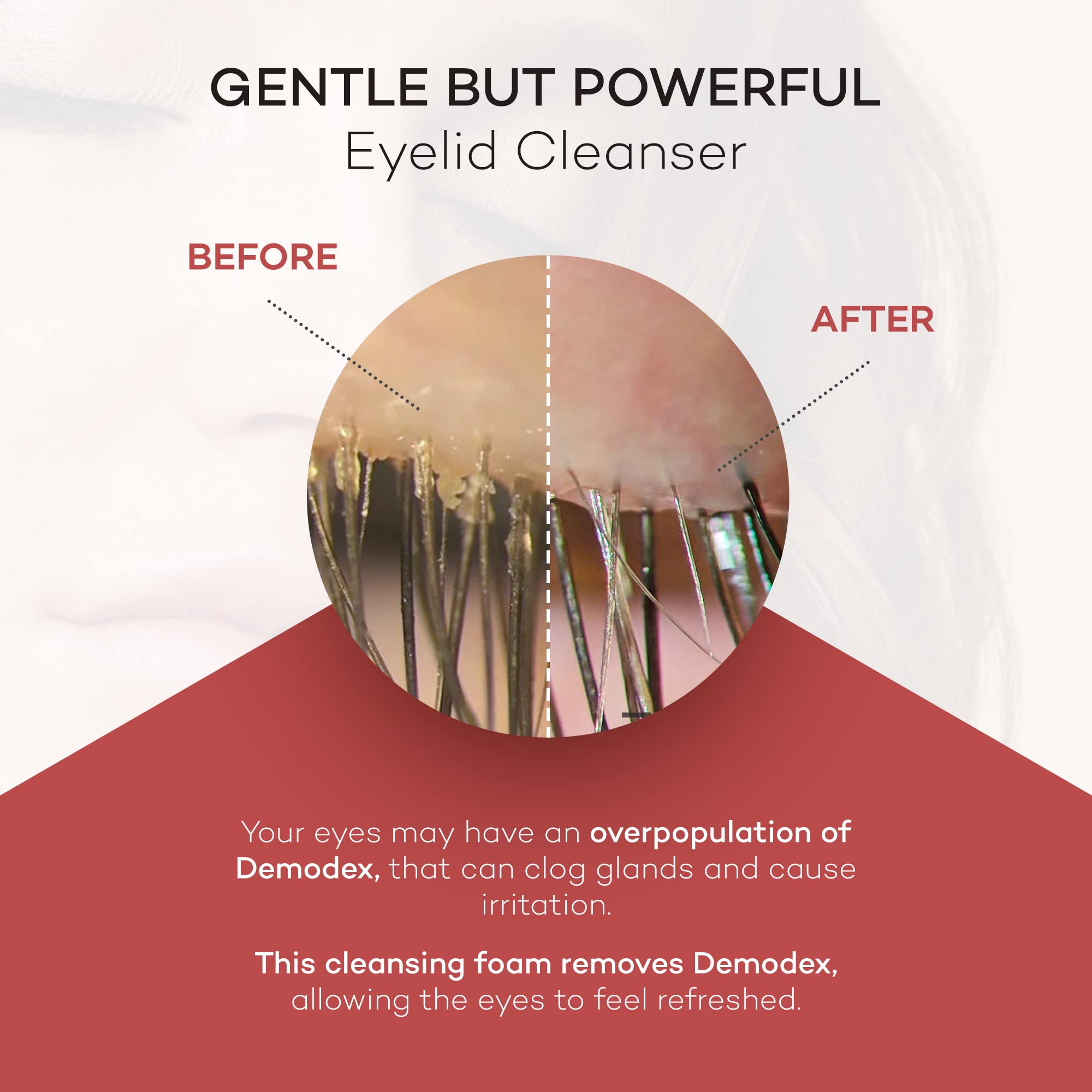 Makeup removal with Zocular ZocuFoam helps remove residue for refreshed lids.