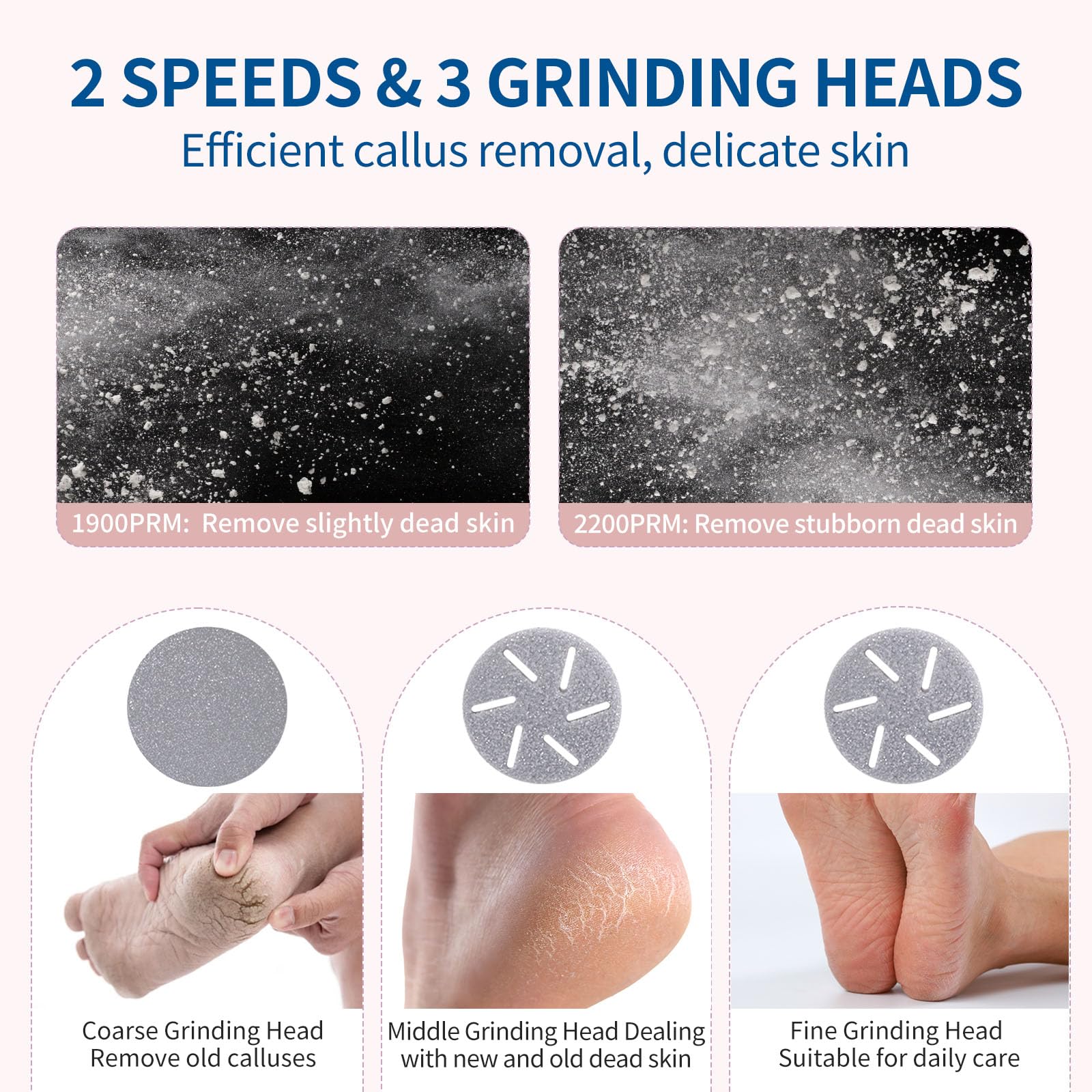 ZOZOO foot callus remover with three roller heads for customizable smoothing.