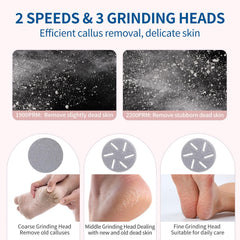 ZOZOO foot callus remover with three roller heads for customizable smoothing.