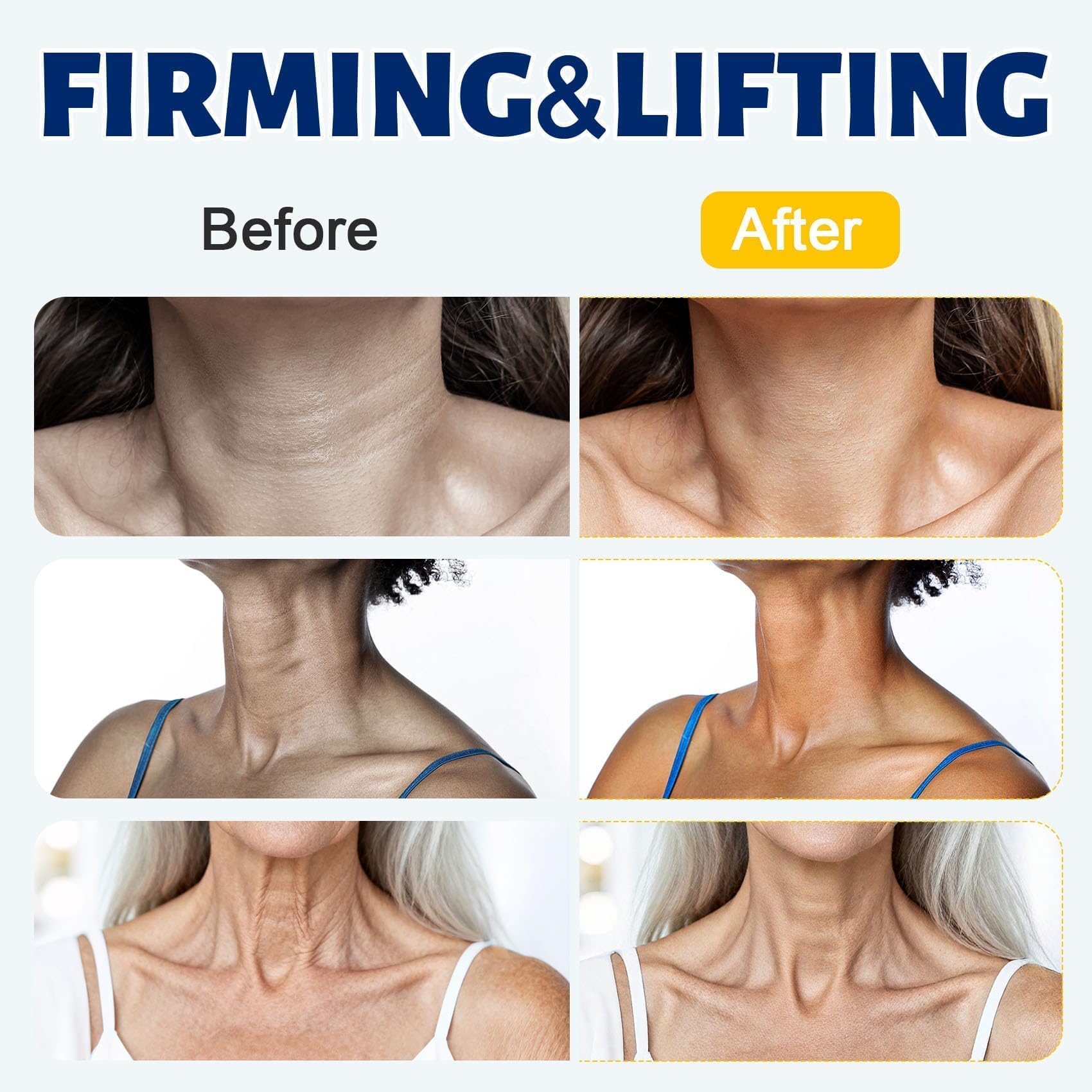Z:SEA three-roller design in action for even neck and chest application