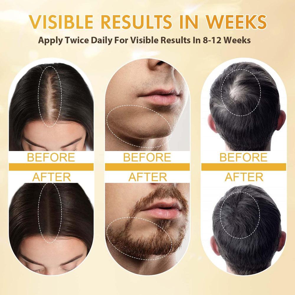 ZYXN Biotin serum bottle showcases nourishing blend aimed at scalp vitality.
