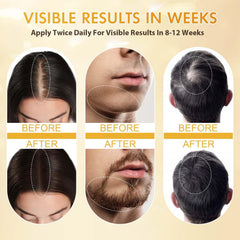 ZYXN Biotin serum bottle showcases nourishing blend aimed at scalp vitality.
