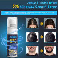 ZYXN minoxidil application on scalp for thicker-looking hair