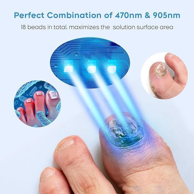 ZZP nail fungus device in use on hands for simultaneous treatment.